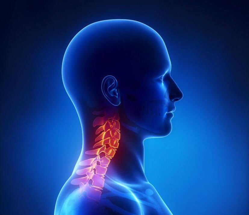 osteochondrosis an spine ceirbheacsach
