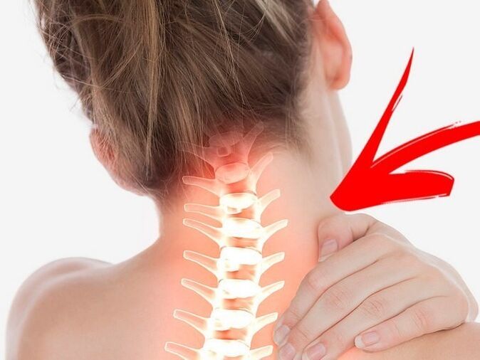 Comhbhrú fréamhacha néaróg le osteochondrosis ceirbheacs