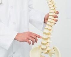osteochondrosis lumbar
