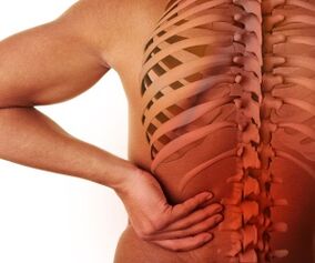 pian ar ais le osteochondrosis lumbar