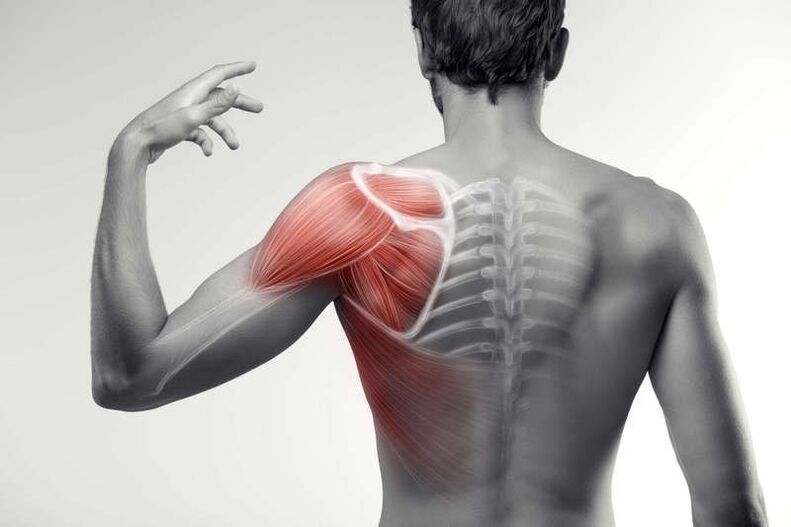 réimsí pian muscle
