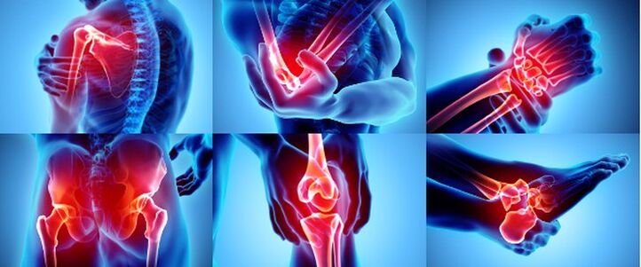 joints inflamed