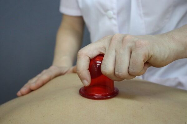 suathaireacht cupping le haghaidh osteochondrosis spinal